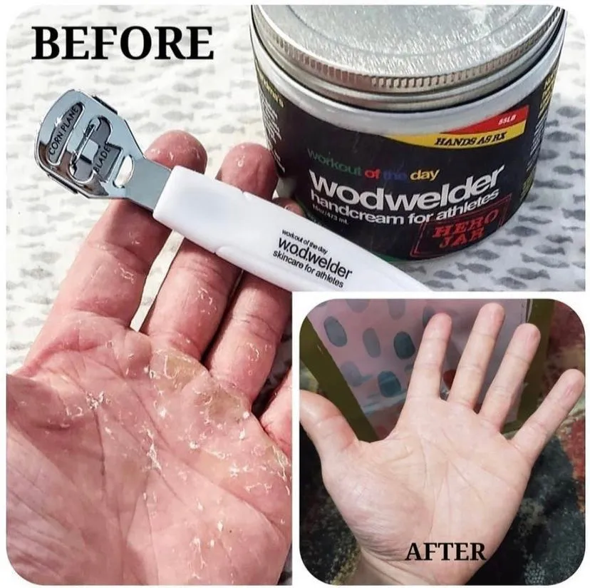 WodWelder Hand Care Kit - Callus Shaver